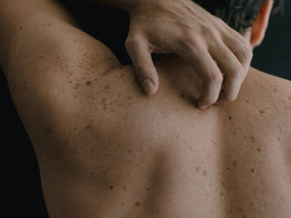 Pain, Itch, and Inflammation; Why You Want to Scratch that Healing Scar