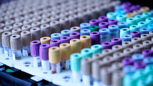 Five types of clinical trial and best comparator sourcing strategies