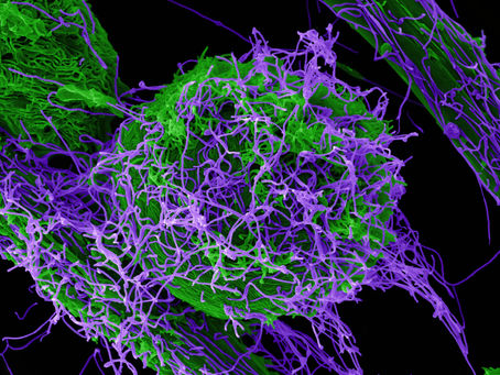 Ebola virus behind massive outbreak in DRC could be mutating, officials say, P4