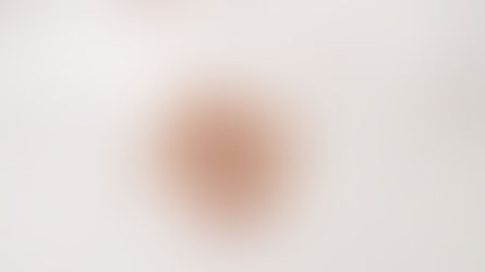 Herpes simplex und Rückenschmerzen | schmerzcenter.com