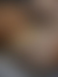 Enlargement and Increase