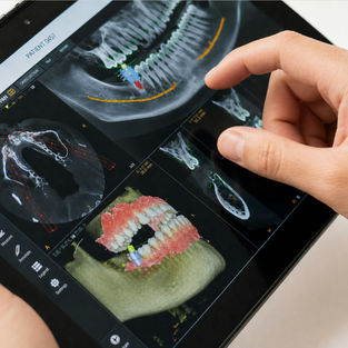 tablet with dental x rays