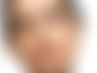 Harmonização Facial na Odontologia: Como Aliar Estética e Saúde para uma Expressão Mais Bela