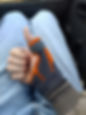 An Employee's Arm in a Cast