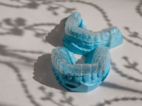 How Much Can Invisalign Fix? Uncover the Possibilities for Your Smile