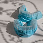 Model of teeth with whitening trays attached