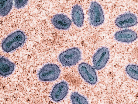 Understanding Monkeypox: Symptoms, Treatment, and Prevention