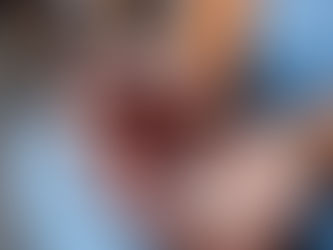 Servidor público dependente químico ou alcoólatra pode ser demitido por faltas ao trabalho?