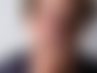 What You HATE When Multiple Sclerosis Crashes Your Party (and How to Kick It Out!)