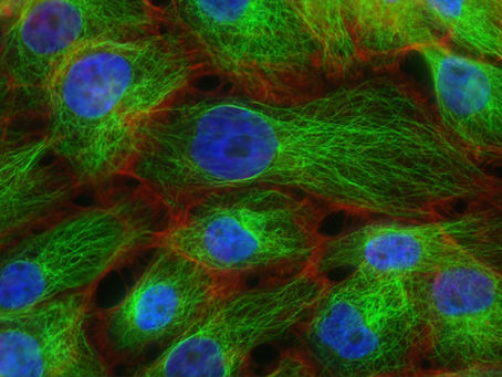 Nucleus Contains Most of the Genetic Material of the Cell?