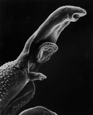 Managing Internal Parasites