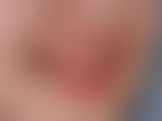 Top 5 Causes of Yellow Teeth and How to Prevent Them