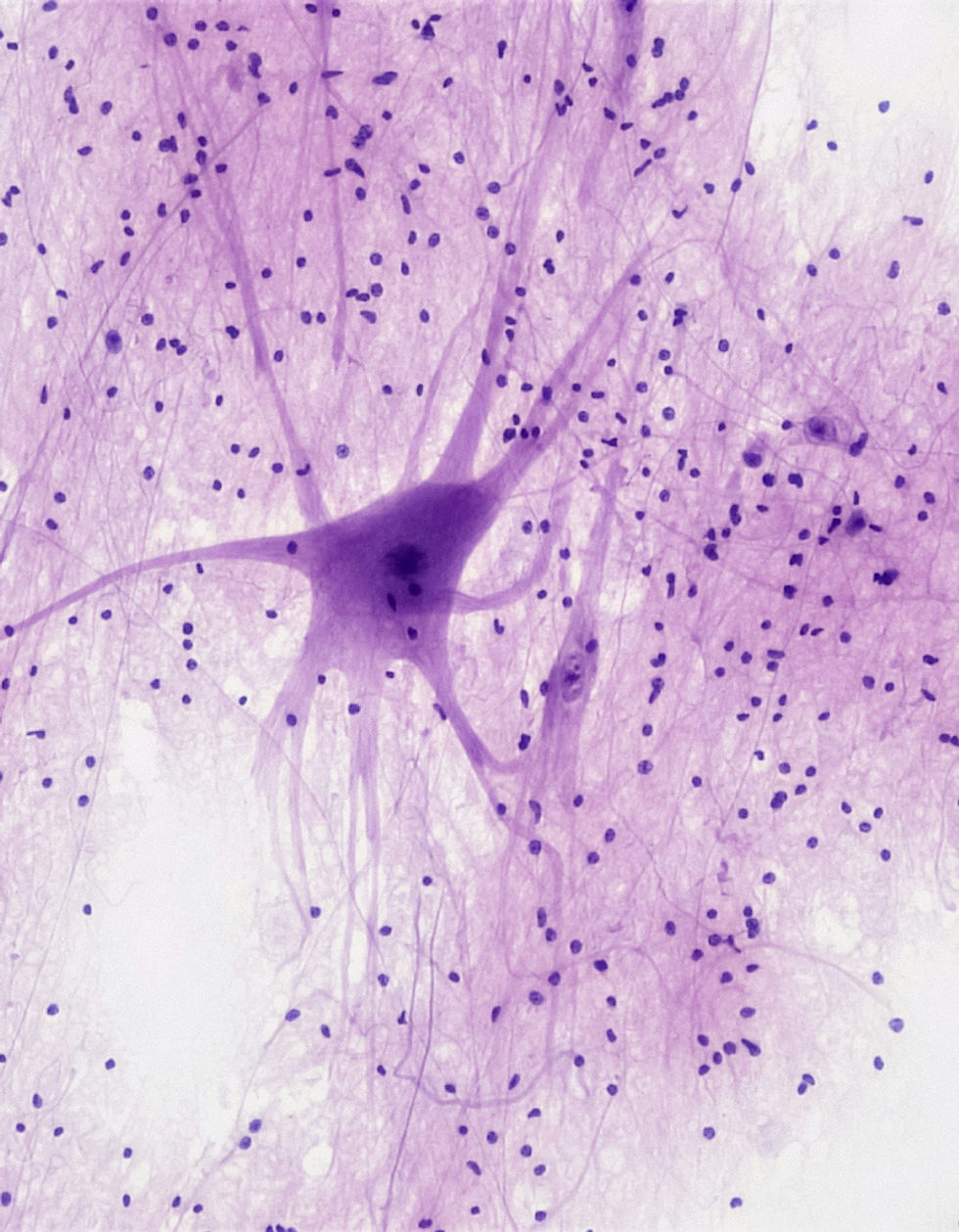 Image by Bioscience Image Library by Fayette Reynolds
