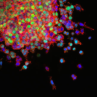 Image by National Cancer Institute