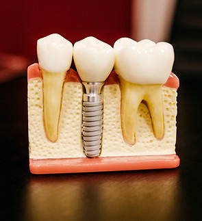 Image by Jonathan Borba