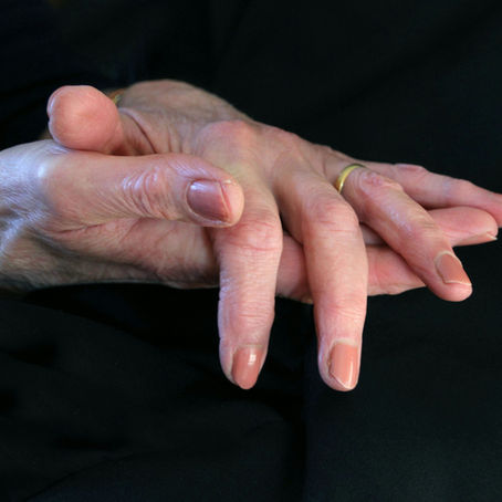 Fenomeno di Raynaud: quando le dita cambiano colore con il freddo