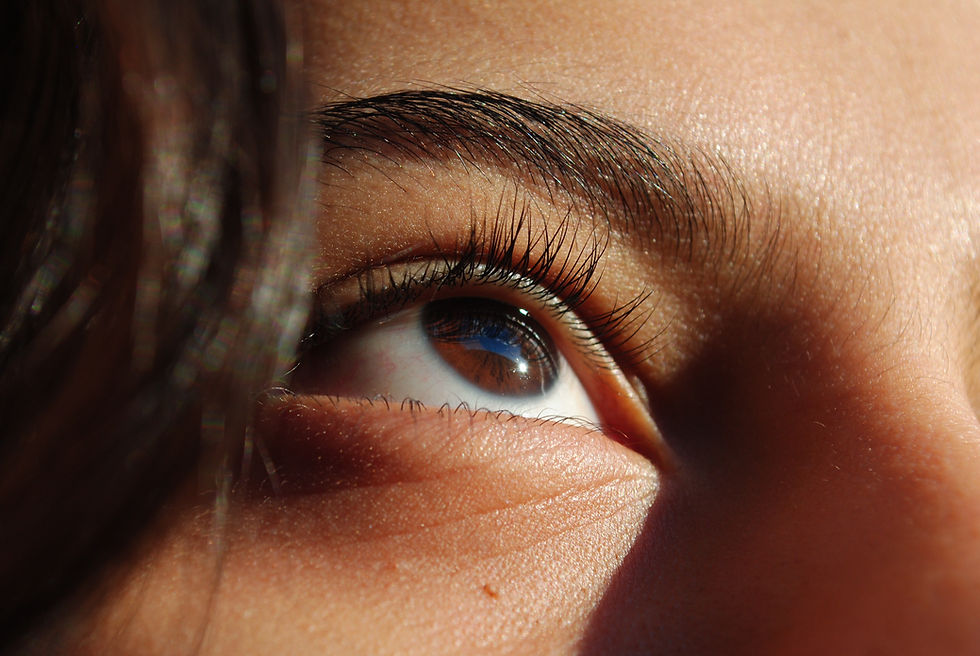 Close up of womans eye and under eye polynucleotide treatment by Nurse Haverhill Suffolk