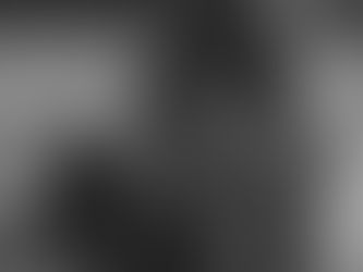 Redefining Rejection Sensitive Dysphoria: A Clinical Misconception Rooted in Misunderstood Emotion