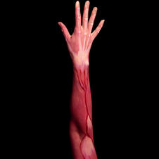 Muscle Strain/Spasm
