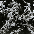 Image by National Cancer Institute