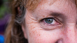 Mounjaro and wrinkles - is there a link?