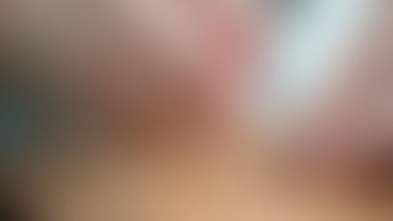 How Acupuncture Enhances Overall Wellness