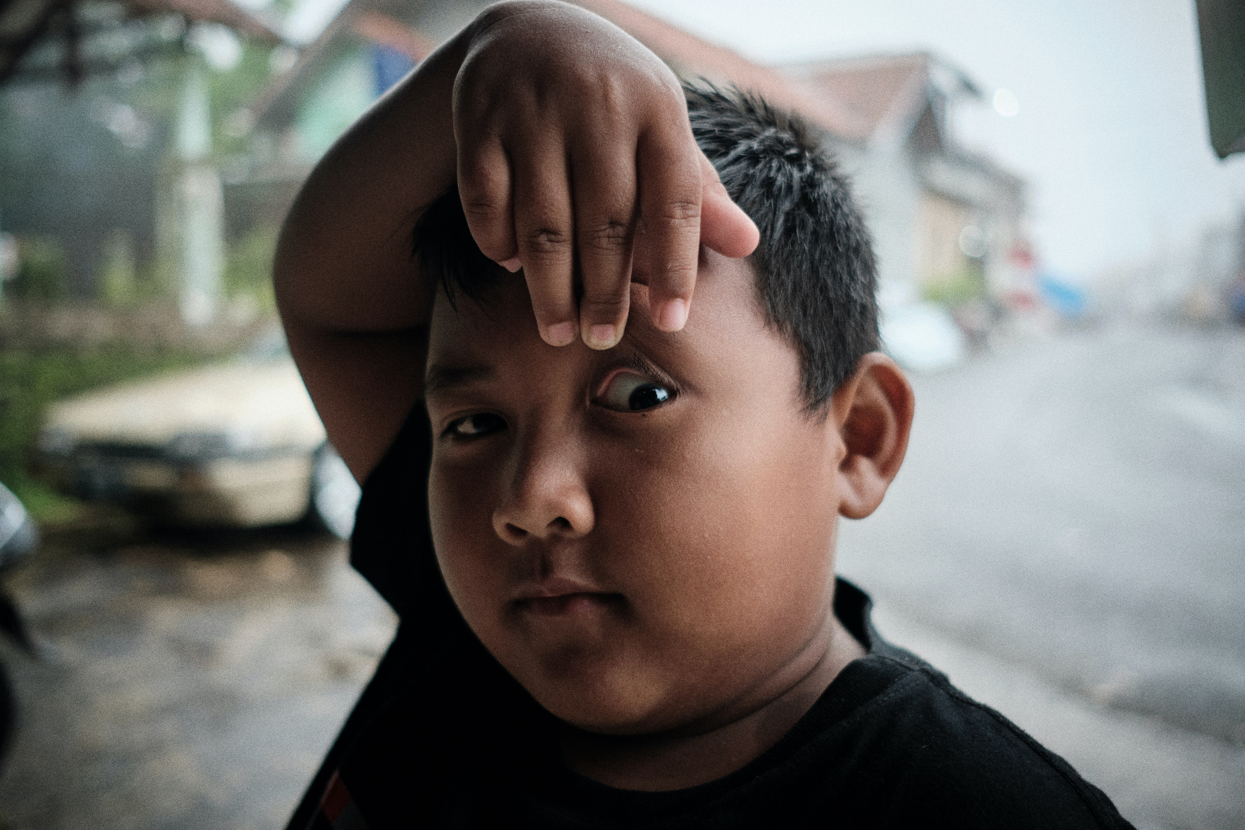 Eye Problems in Young Adults: Why They’re Increasing | South Bay Retina