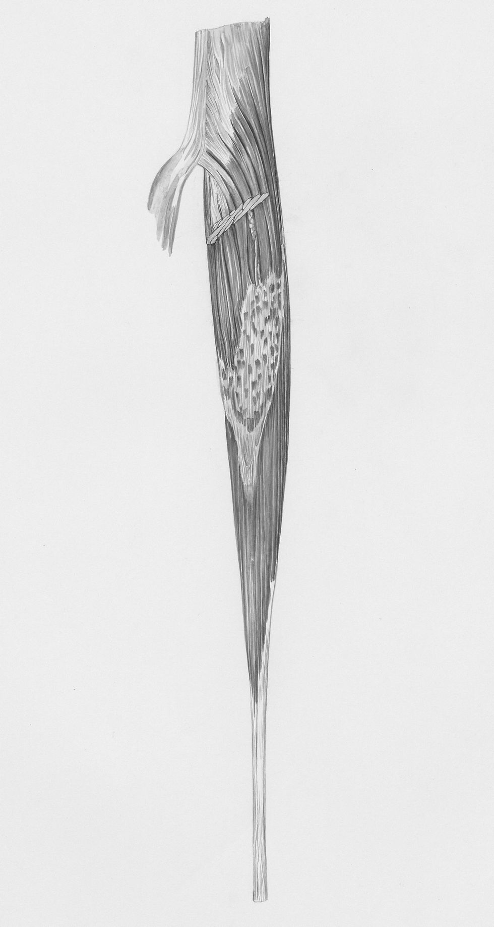 Image illustrating anatomy showing muscle-tendon junction and bone attachment, explaining tendon injury prevention concepts for athletes in Vermont