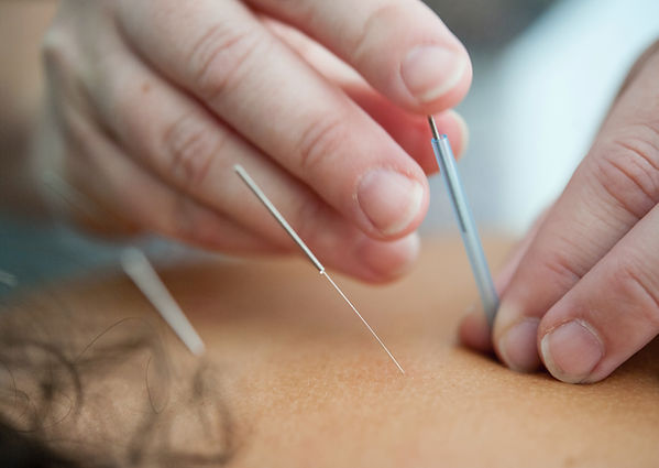 Chinese Medical Centre TCM Acupuncture