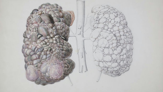 Urology Compounding