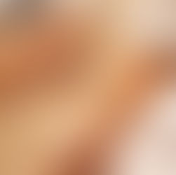 Laser hair removal near Northville, mi: how it works, what it feels like, and starting price