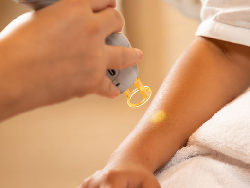 Laser Hair Removal Near YOU
