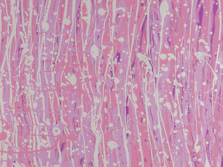 Understanding the Complex Process of Fracture Healing