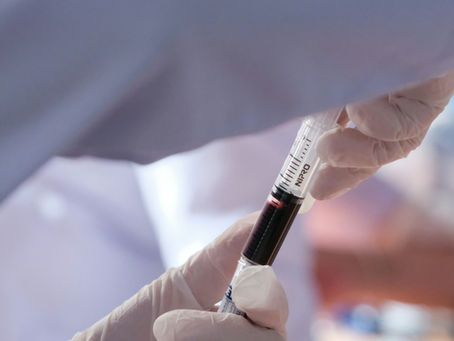 Homocystein – was du über den wichtigen Stoffwechselwert wissen solltest