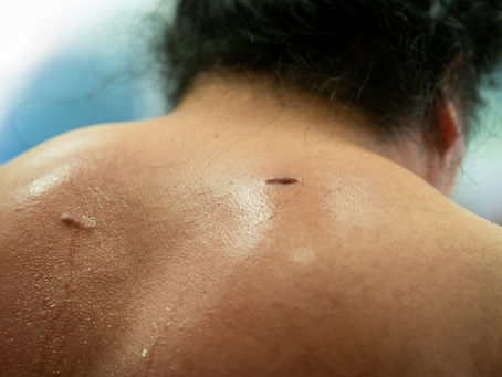 Scar Tissue: The Hidden Reason Your Pain Keeps Returning
