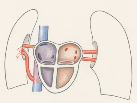 What the Research Says About Nadi Shodhana (Alternate Nostril Breathing)