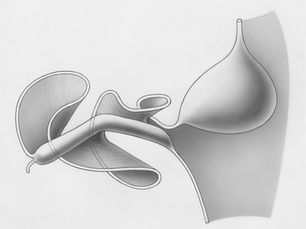 Larazotide and the Intestinal Barrier