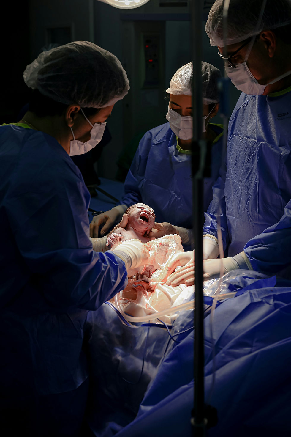 To the Mothers Who Had Surprise C-Sections