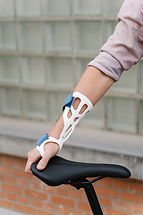 SnugFit arm prosthetics