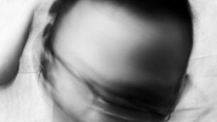 Migräne verstehen und wirksam behandeln: Ein umfassender Leitfaden