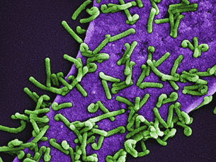 What is the Microbiome? Discovering the Micro-World Within Us