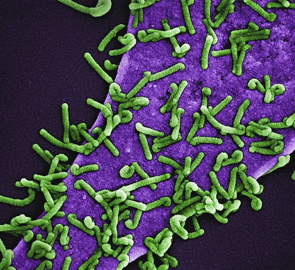 Image by National Institute of Allergy and Infectious Diseases