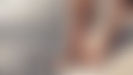 中年婦女雙下肢血管炎紫斑中醫治療