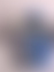 GLP1+GIP+Glucagon RA (Retatrutide™)