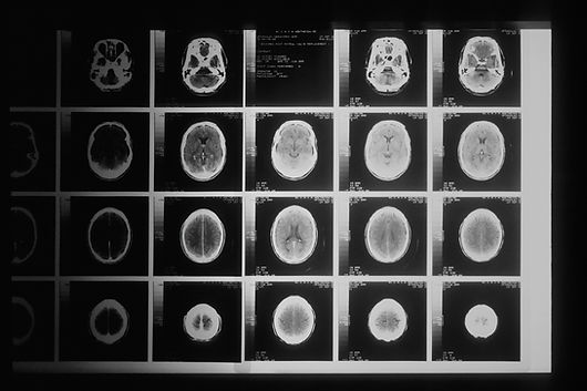 Image by National Cancer Institute