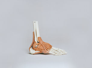 Understanding Achilles Tendinopathy — Why Progressive Loading Beats Rest for Recovery