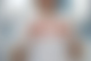 A dental professional holds two dental molds, one with braces, in a clinic. They wear white gloves and a uniform, with a blurred background.