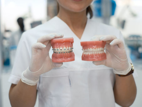 Invisalign vs Braces in Hove: Which Teeth Straightening Option is Right for You?