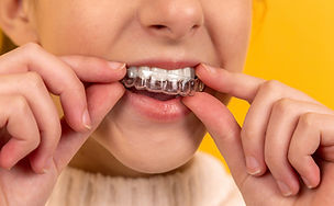 Invisalign Teen