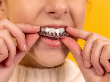 Teeth Whitening Tray